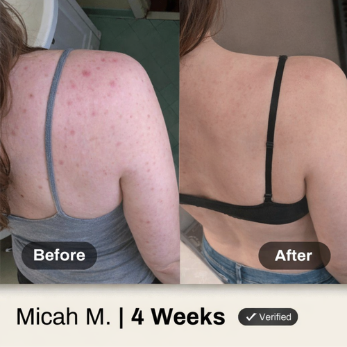 NERIVAL™ Body Wash 150ml - FREE