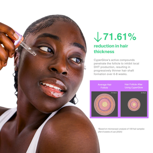 Cyperus Rotundus FREE BUNDLE