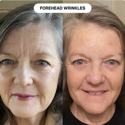 Nerival™ Line Filler Primer