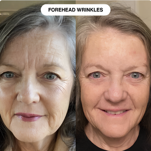 Nerival™ Line Filler Primer