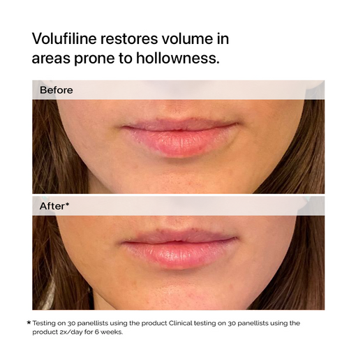 Restore Volume & Fullness - Deep Volufiline